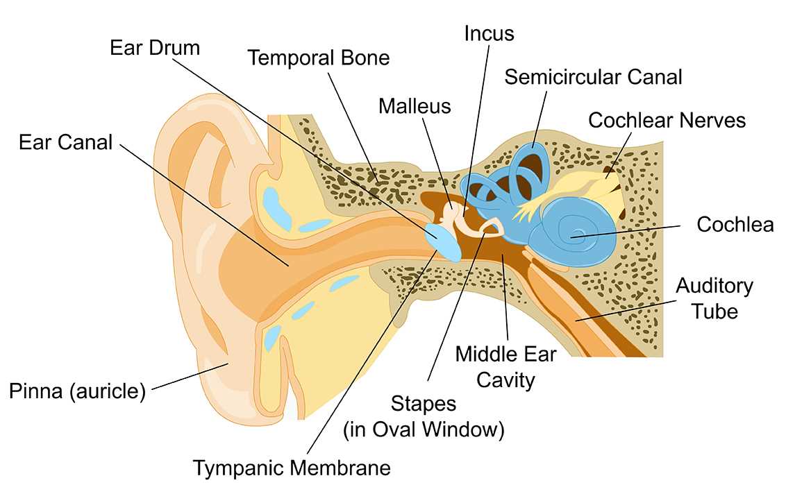 cochlear implant parts diagram