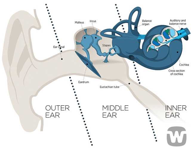 cochlear implant parts diagram