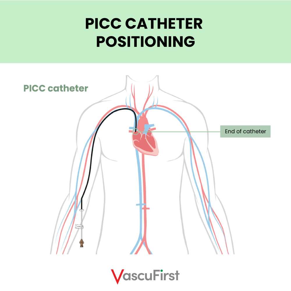 picc line parts diagram