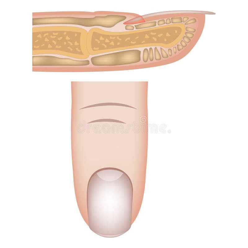 nail parts diagram