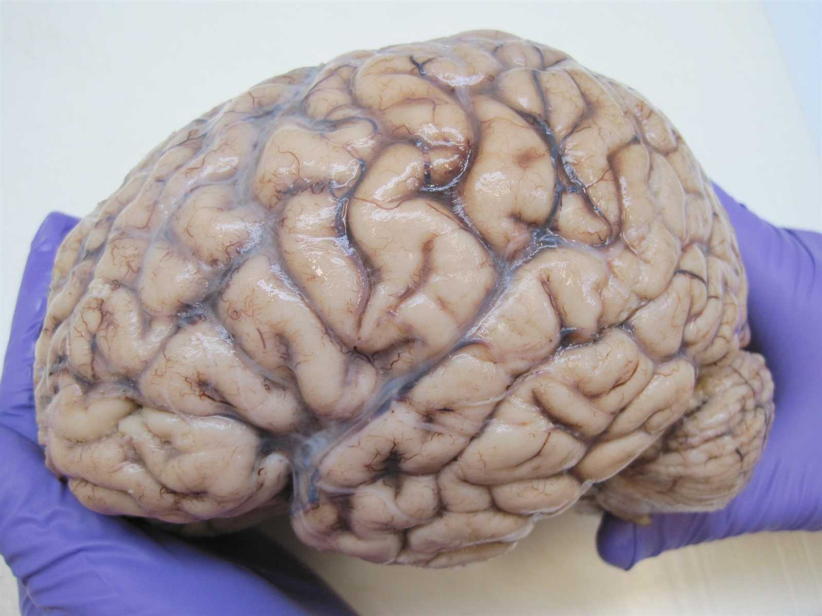 parts of the brain and functions diagram