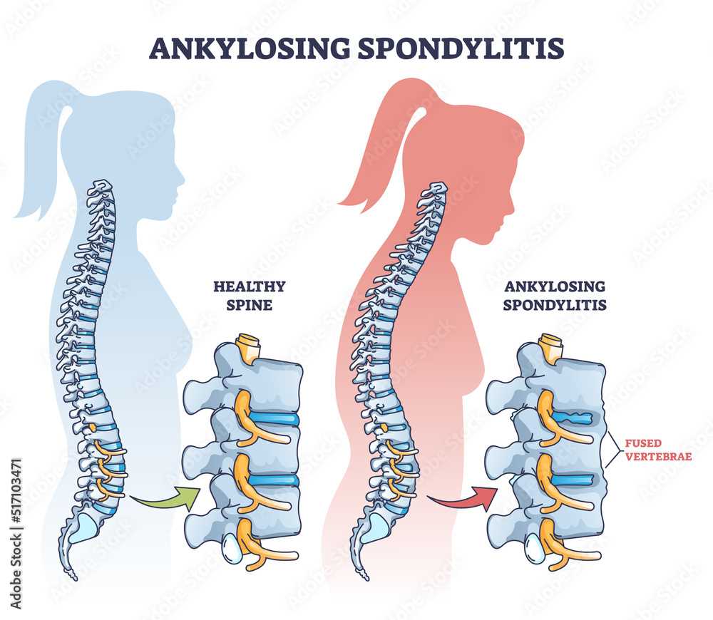 spine parts diagram