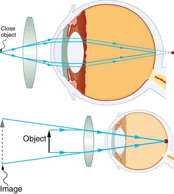 eye glasses parts diagram